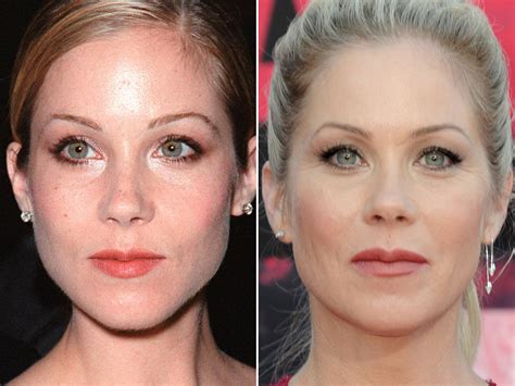 Christina Applegate Before And After The Skincare Edit