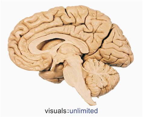 Sagittal Section Of Brain Cloudshareinfo