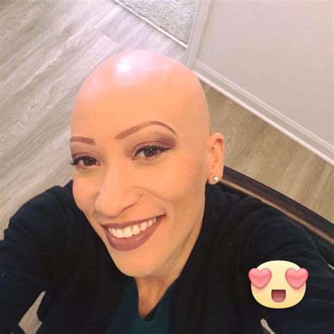 Augusta Georgia Alopecia Support Group