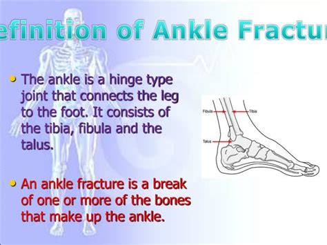 Ppt Ankle Fracture Powerpoint Presentation Id3744012