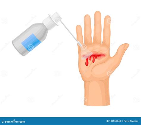 Hand With Wound Streaming Blood Cleaning With Pharmaceutical Substance