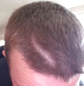What does the science say? Cowlick in the front makes me look balding, what can I do ...