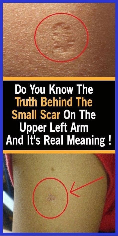 do you know the truth behind the small scar on the upper left arm and its real meaning diane