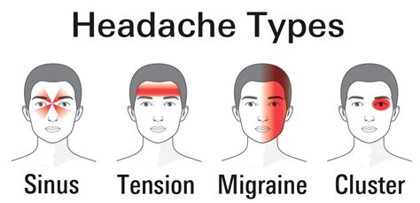 Migraines And Treatments