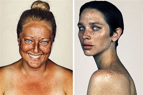 Beauty Of Freckled People Documented By Brock Elbank News