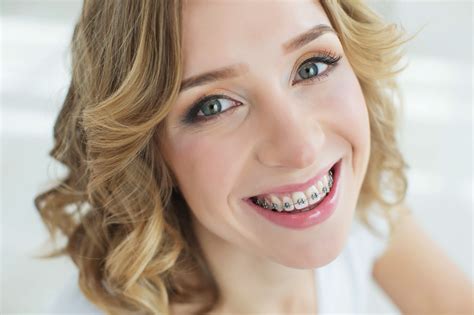 the 5 best braces options for adults traditional braces orthodontics dental