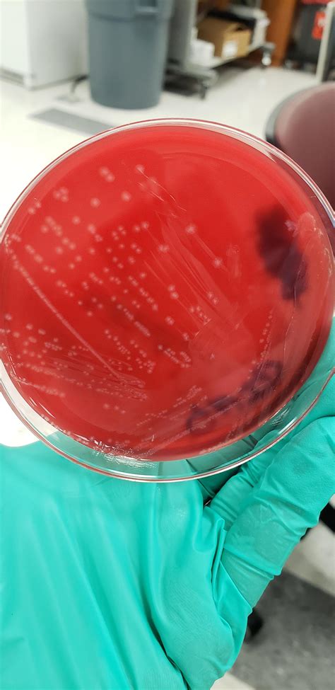 Gram Positive Rods Hemolytic On Blood Agar In Blood Culture What Is
