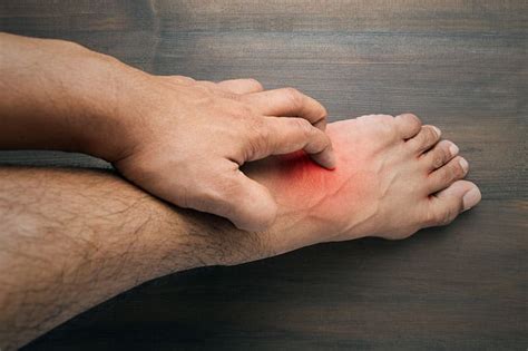 5 Common Rashes That Cause Foot Irritation Walkrite Foot Clinic