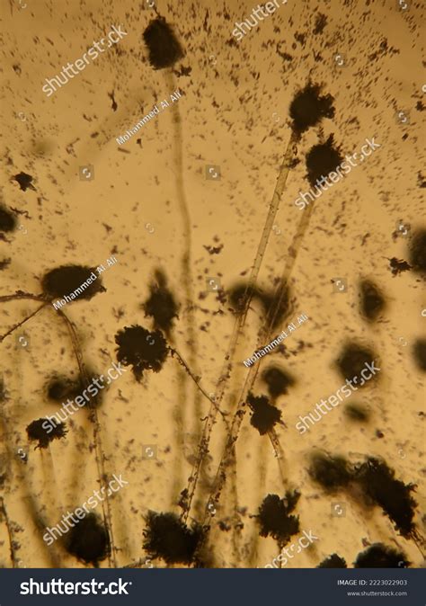 Photo Fungi Mycelia Spores Under Microscope Stock Photo 2223022903