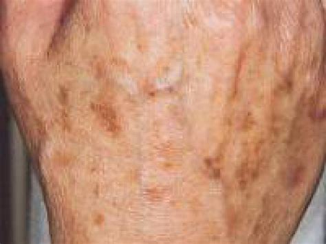 Maybe you would like to learn more about one of these? Skin Care Laser Center GmbH Dachau. Kosmetikstudio für ...