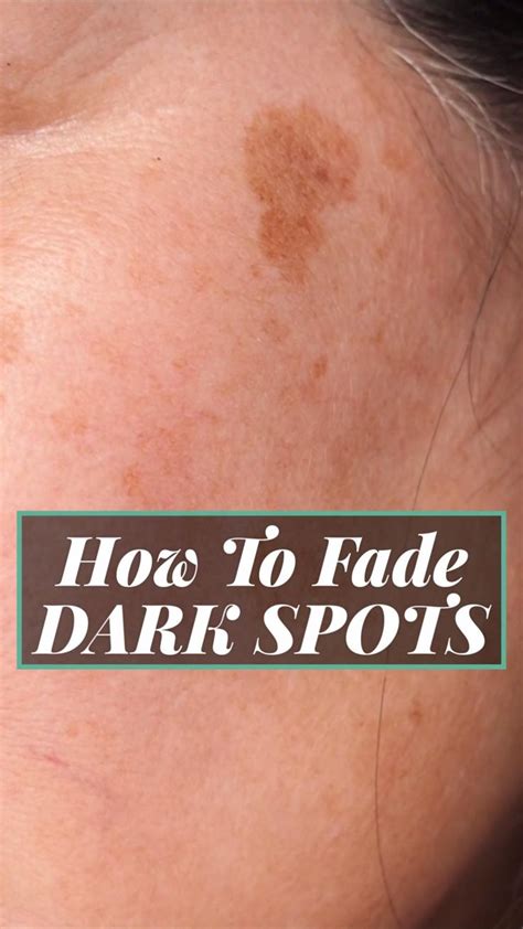 How To Fade Dark Spots Naturally Video In 2021 How To Fade Facial