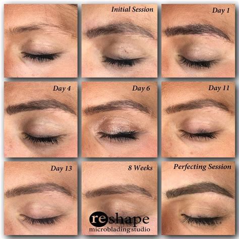 Eyebrow Tattoo Removal Healing Process A Lot Of Clients Get In Touch