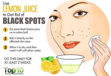 Home Remedies For Black Spots On Your Face Top 10 Home Remedies