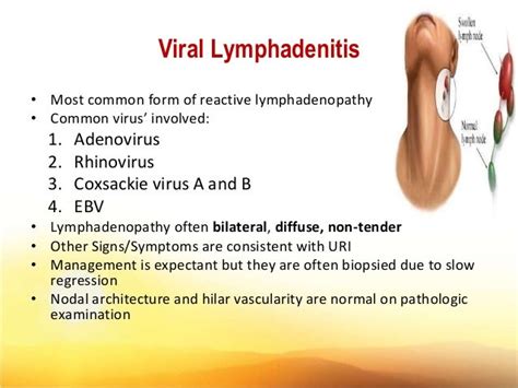 Clinical Approach Fever Lymphadenopathy