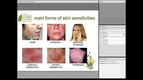 Sensitive Skin Symptoms Causes And Treatments Youtube