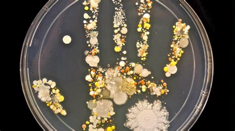 Striking Photo Shows All The Bacteria On An 8 Year Olds Hand