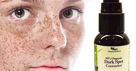 Facial Beauty Treatments For Dark Spots Rijal S Blog
