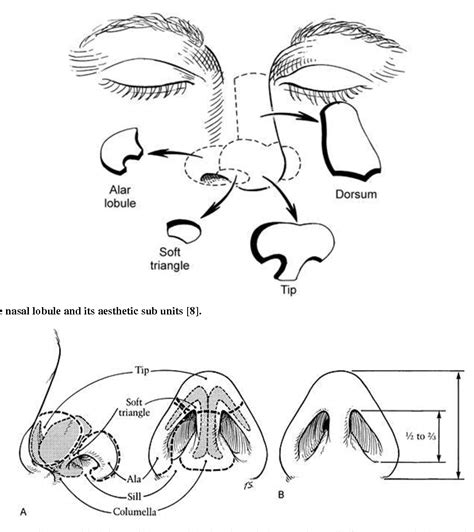 Figure 4 From Reconstruction Of The Nasal Defects By Nasolabial Flaps