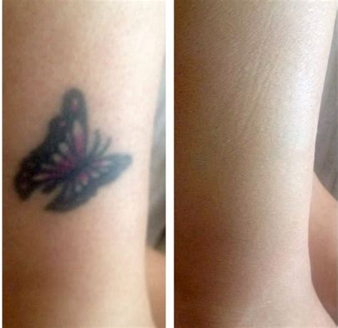 Butterfly Tattoo Before And After Veil Cover Cream Veil Cover Cream