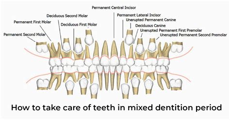 How To Take Care Of Teeth In Mixed Dentition Period Sky Dental Care