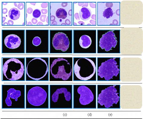 Five Types Of Wbc Cell Neutrophil Lymphocyte Eosinophil Monocyte Hot