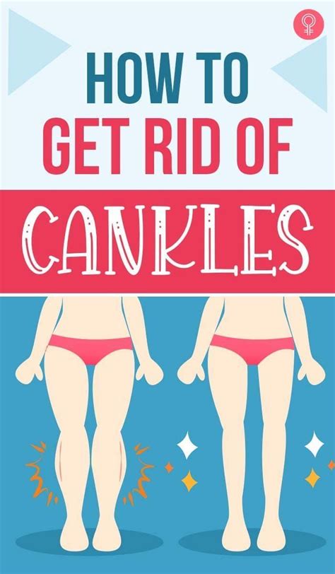 How To Get Rid Of Cankles Artofit