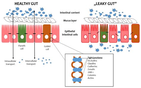 Ijms Free Full Text Overview Of The Importance Of Biotics In Gut