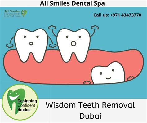Wisdom Teeth Removal Dubai | Wisdom teeth removal, Wisdom teeth, Smile dental
