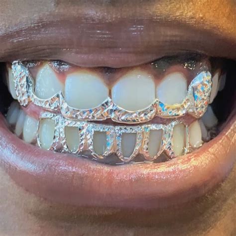 Open Face Grillz With Diamonds