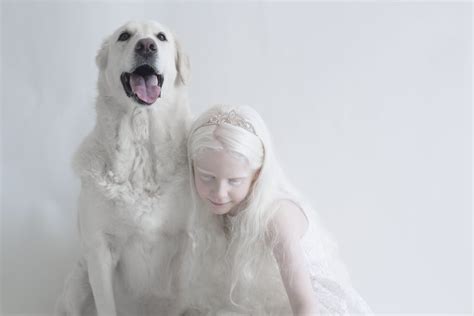 Albinism Photographs Yulia Taits POPSUGAR Beauty