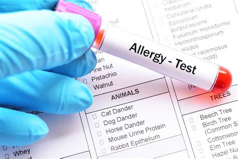 How To Read Allergy Test Results