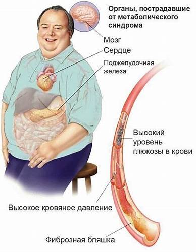 Похудеть метаболический синдром Причини і патогенез метаболічного синдрому Причини і патогенез метаболічного синдрому Похудеть метаболический синдром