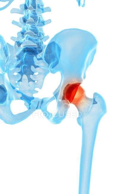 Human Hip Pain — Joints Sore Stock Photo 160556742