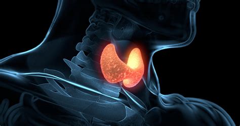 Cancer De La Thyroïde Symptômes Facteurs De Risque Et Prévention