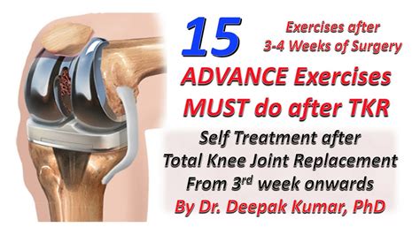 Advance Exercise After Month Of Tkr Total Knee Replacement