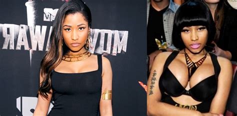 Nicki Minaj Plastic Surgery Before And After Photos