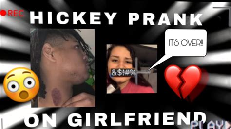 Hickey Prank On Girlfriend 😮 Youtube