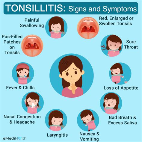 How Is Tonsillitis Diagnosed And Treated Emedihealth