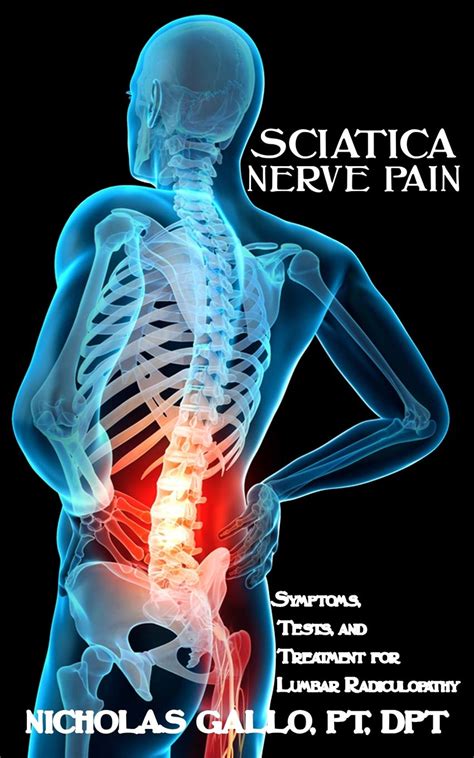 11 Sciatic Nerve Pain Solutions Nerve Zone
