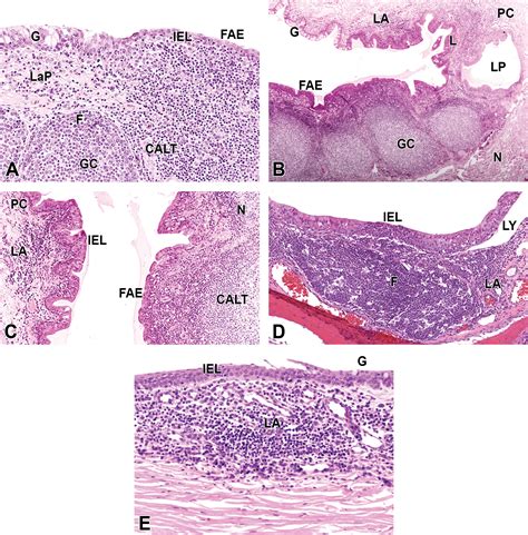 Mucosa Associated Lymphoid Tissue