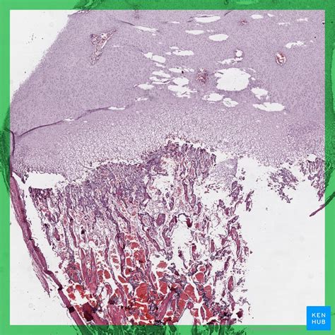 Bone Formation Histology And Process Of The Ossification Kenhub