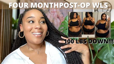 Four Month Weight Loss Surgery Update Wpictures Down 100 Lbs Sadi S