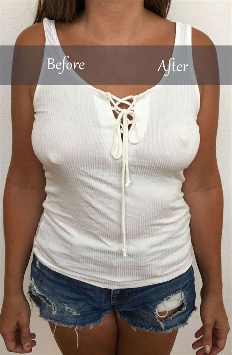 Breast Lifts Are Here And The Results Are Clear Get Lift Coverage And Cleavage With Breast