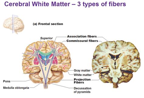 Cerebral White Matter And Gray Matter And Basal Ganglia