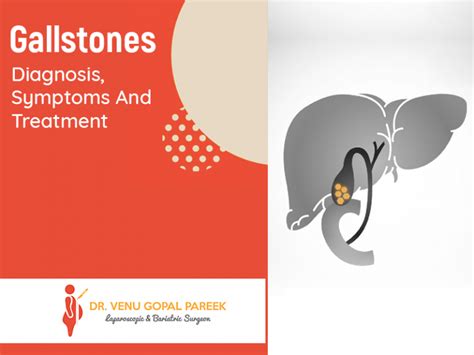Gallstones Diagnosis Symptoms And Treatment