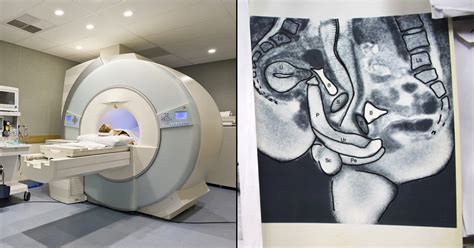 A Couple Had Sex In An Mri Machine All For Science Scoopwhoop