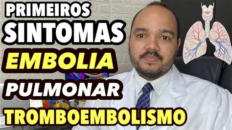 PRIMEIROS SINTOMAS DO TROMBOEMBOLISMO PULMONAR EMBOLIA PULMONAR YouTube