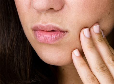 What Are Canker Sores And How Do You Get Rid Of Them Self