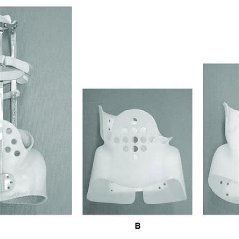 Various Types Of Brace A Ctlso Milwaukee Brace B Tlso Boston