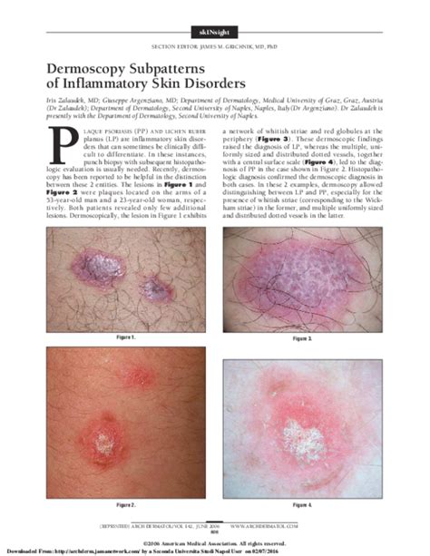 Pdf Dermoscopy Subpatterns Of Inflammatory Skin Disorders Giuseppe